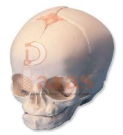 Fetal Skull