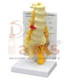 Lumbar
Sacrum with
Herniated Disc