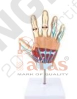 Hand Arthritis Model