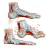 Foot Anatomy Model 3 Parts (Normal, Flat and Arched Foot)