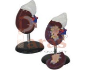 Human Kidney Model
With Adrenal Gland