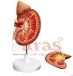 Large Kidney Model