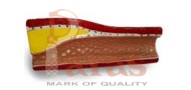 Artery Model