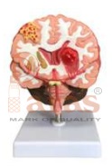 Brain Stroke Model