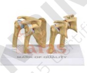 Stages Ostearthritis Shoulder
Model