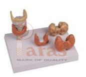 Thyroid Disease Model