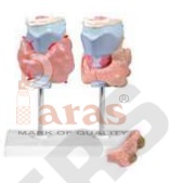 Thyroid Disease Model