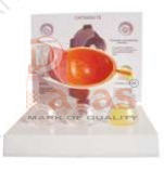 Human Cataract Eye
Model
T