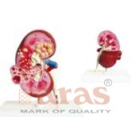 Kidney Cyst Model