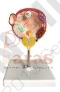 Diseased Bladder And
Prostate Model