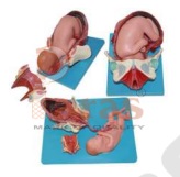 Demonstration Model of Child Birth (3 Stages)
