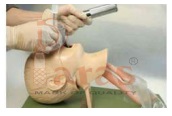 Child Trachea Intubation
Model
