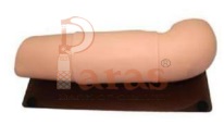 Subcutaneous
Embedded Contraception Arm